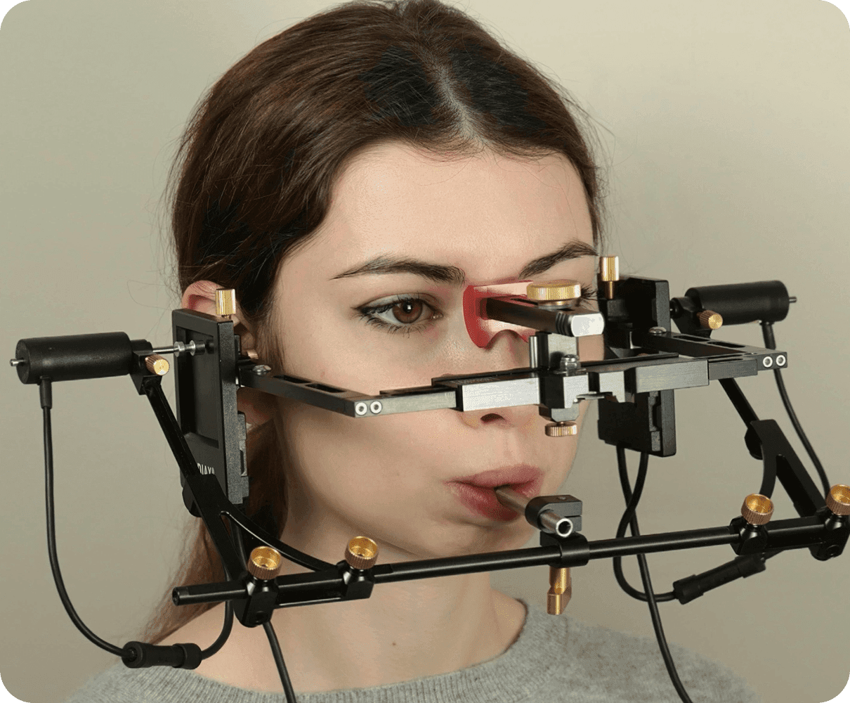 Кондилография