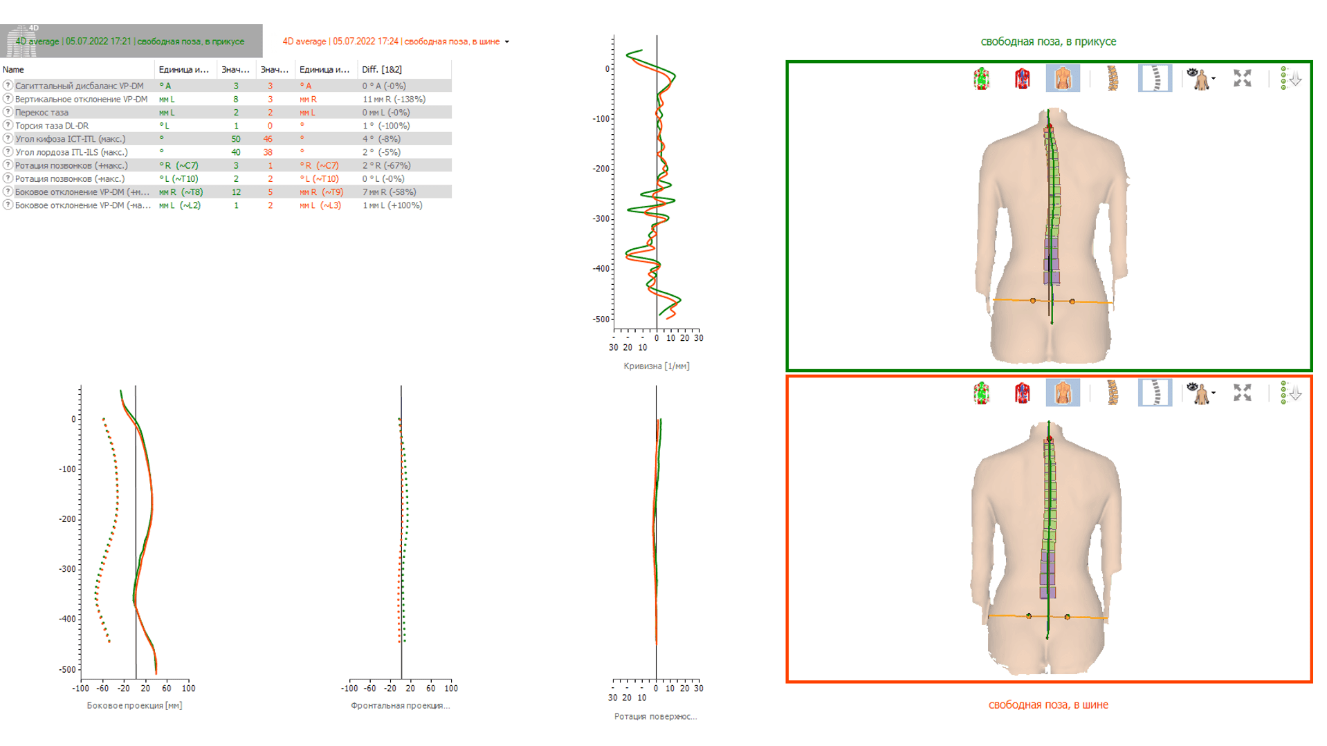 DIERS 4D motion® Lab