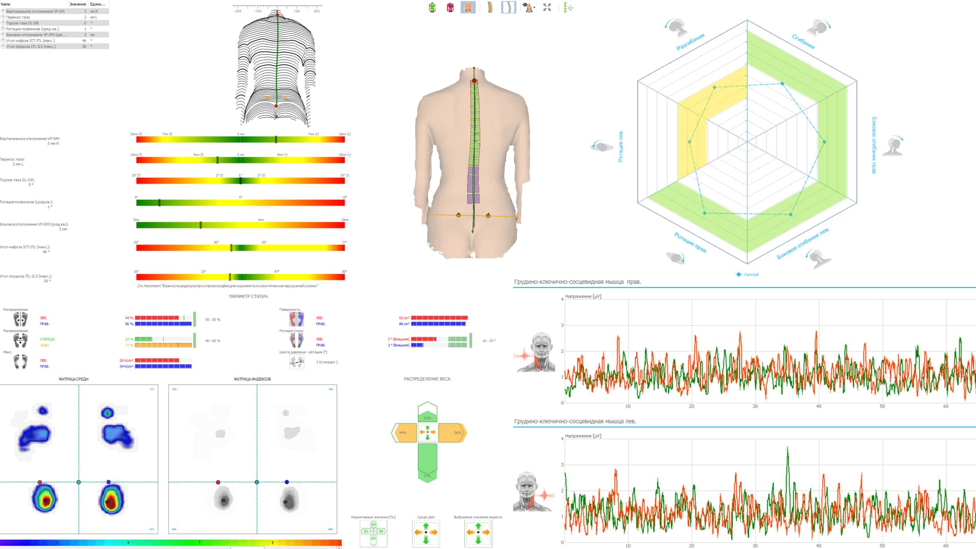 DIERS 4D motion® Lab