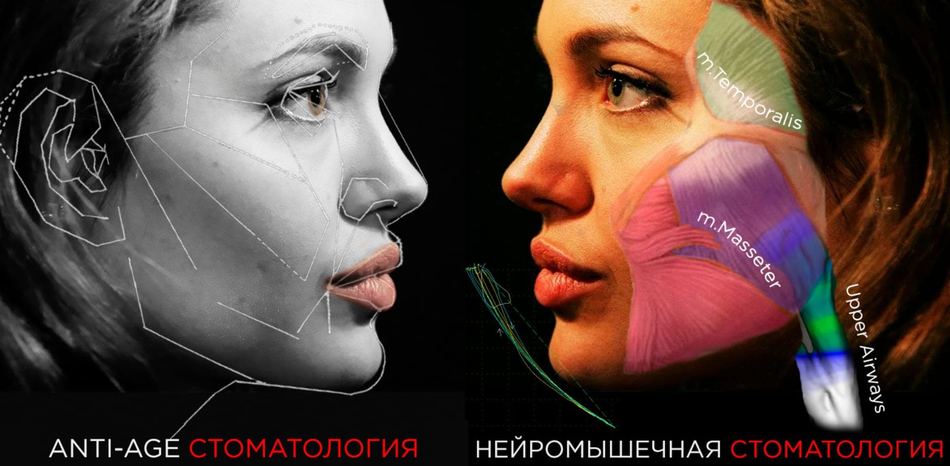 Aнтиэйдж и нейромышечная стоматология