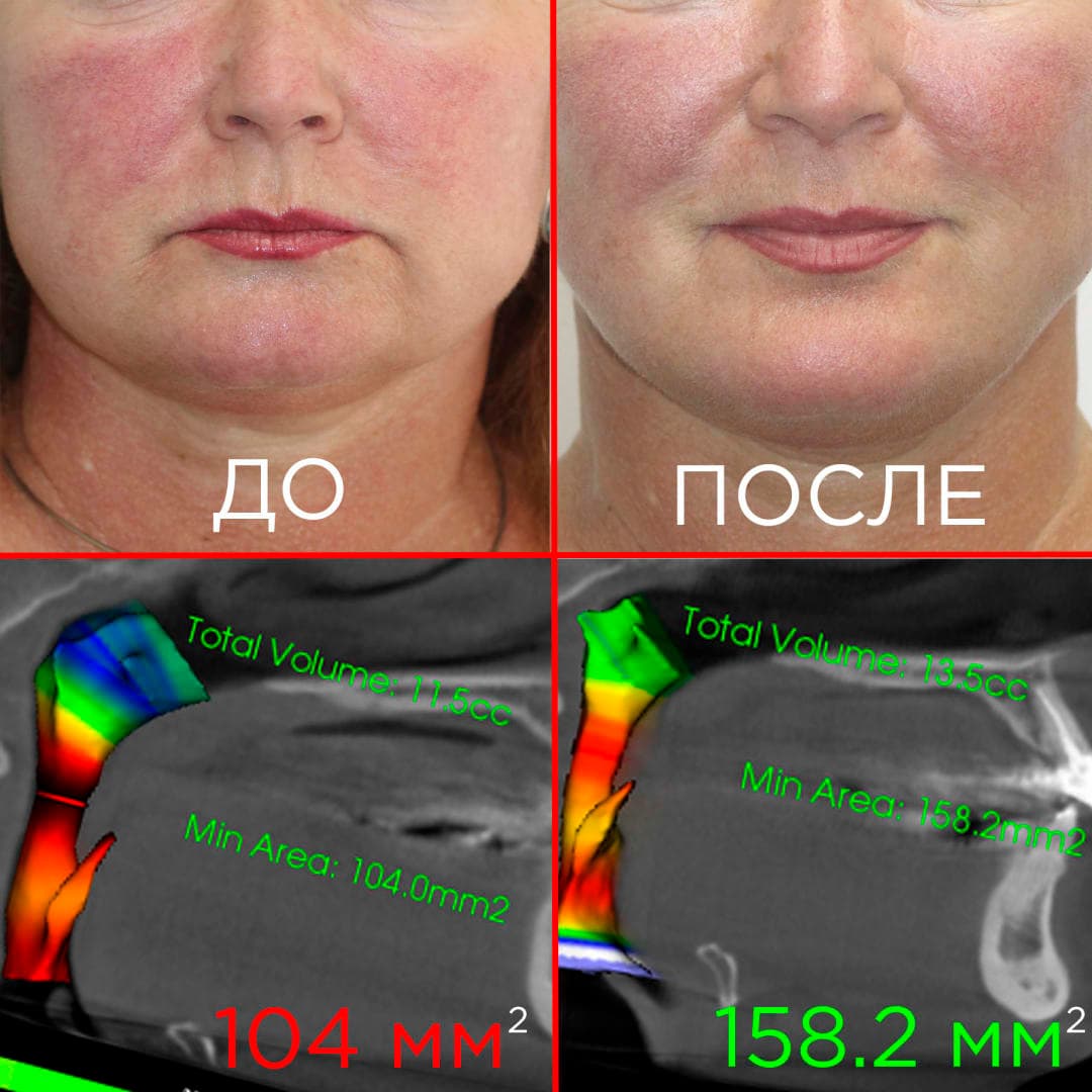 Aнтиэйдж и нейромышечная стоматология image