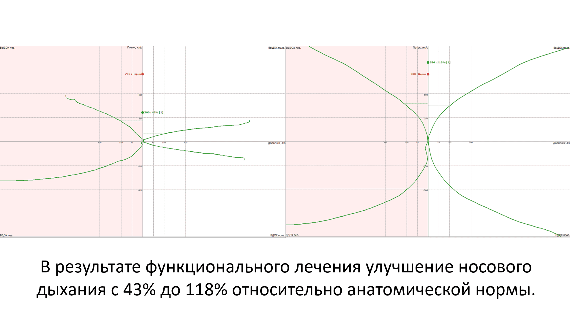 Кондилография