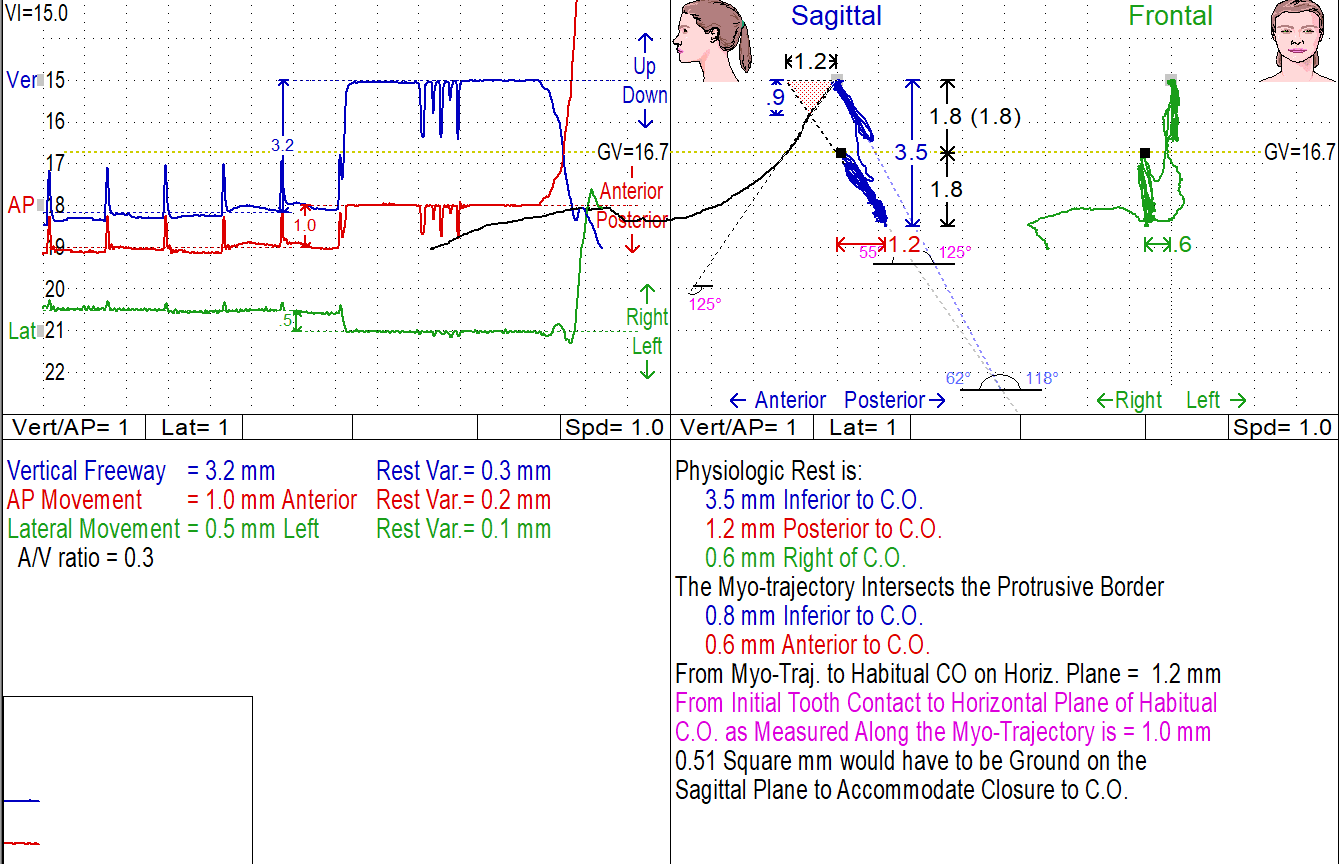 К7 X Evaluation System