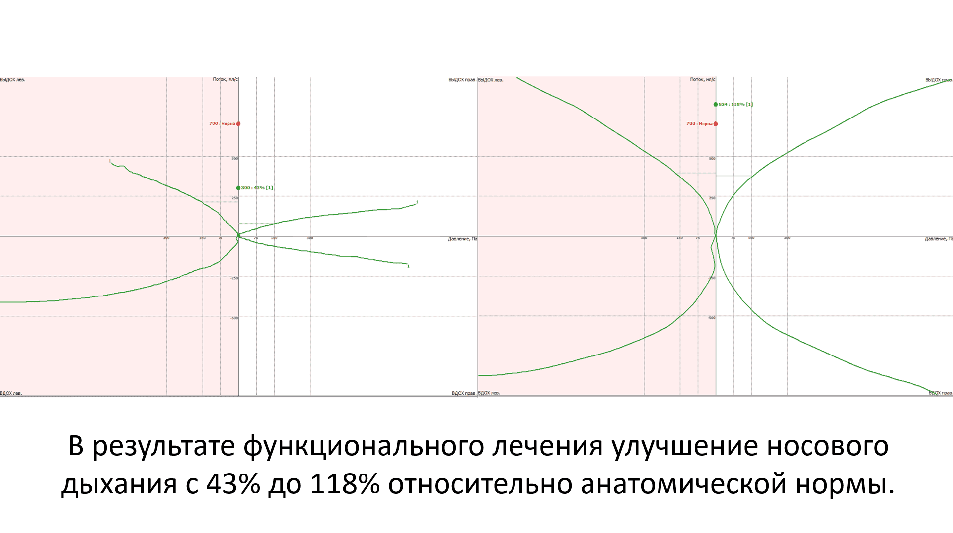 Кондилография