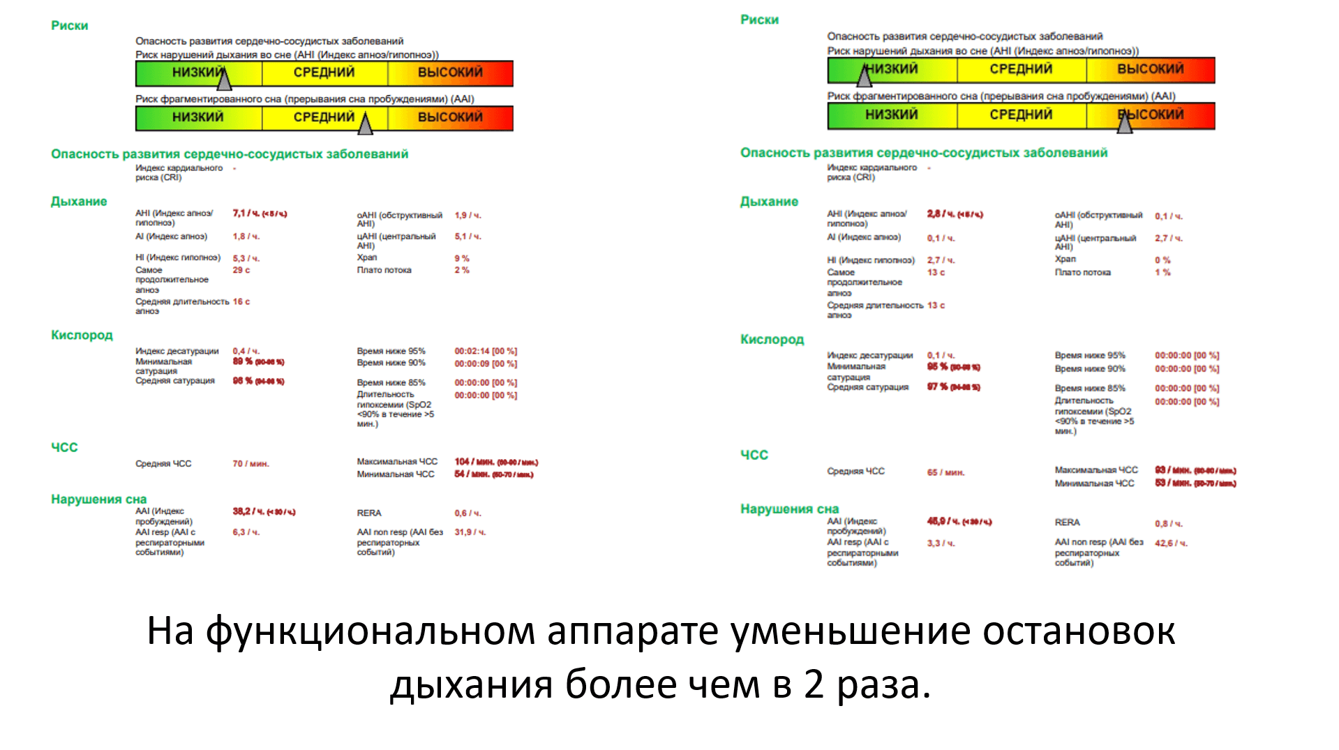 Сомнология