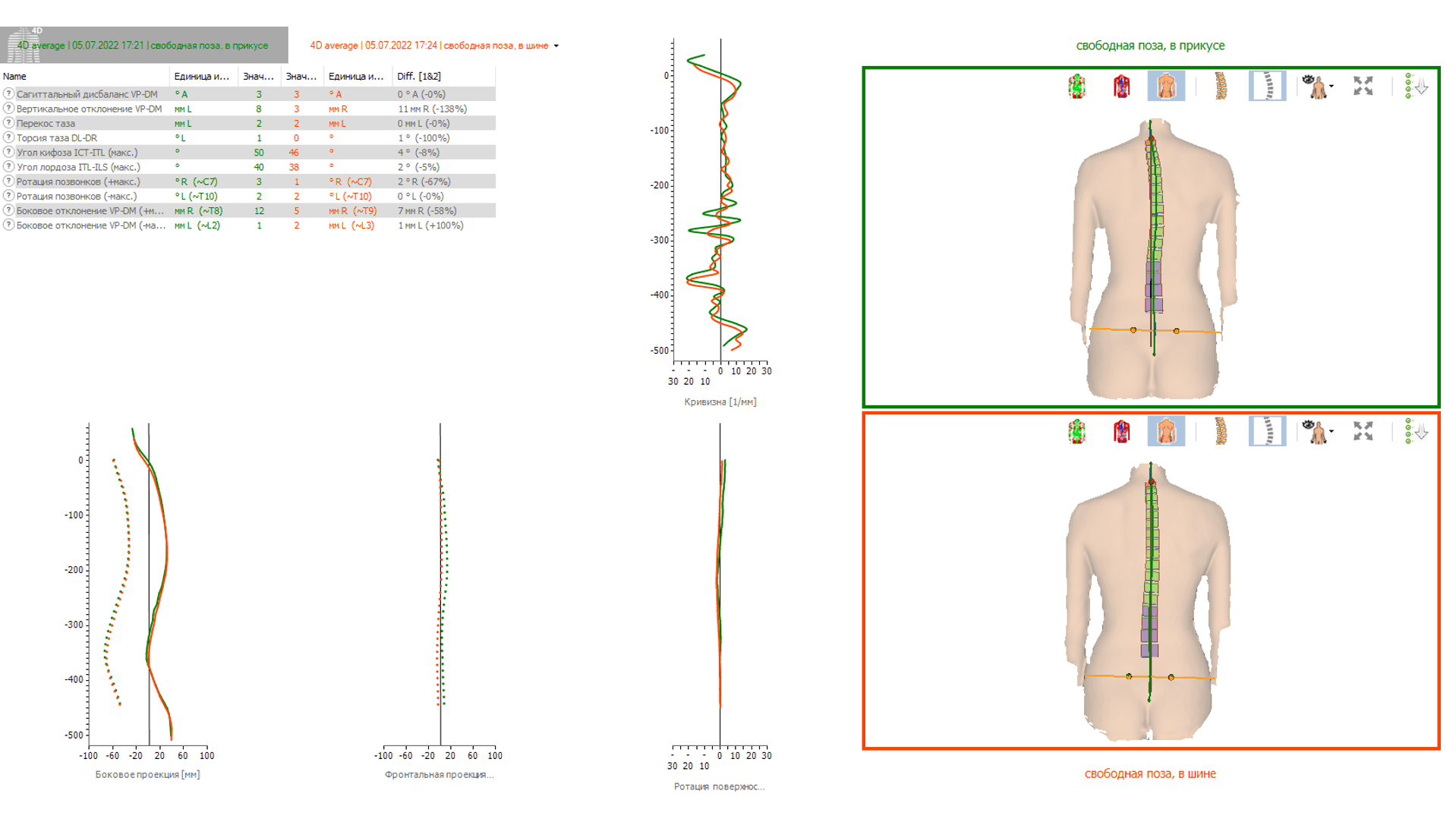 DIERS 4D motion® Lab